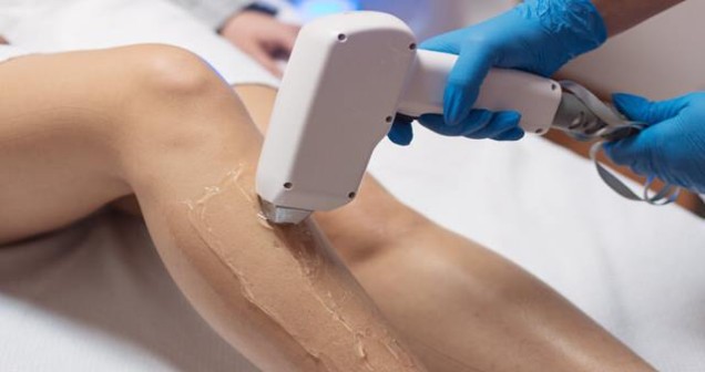 Lazer epilasyon zararları nelerdir?